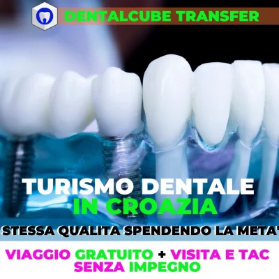 impianti dentali hai perso i denti denti fissi in giornata denti nuovi all 4 all 6 implantologia dentista denti nuovi dentiera fissa low cost (1)